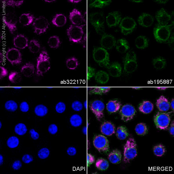 Immunocytochemistry/ Immunofluorescence - Alexa Fluor® 488 Anti-alpha Tubulin antibody [DM1A] - Microtubule Marker (ab195887), expandable thumbnail