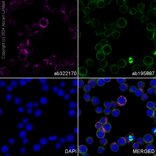 Immunocytochemistry/ Immunofluorescence - Alexa Fluor® 488 Anti-alpha Tubulin antibody [DM1A] - Microtubule Marker (ab195887), expandable thumbnail