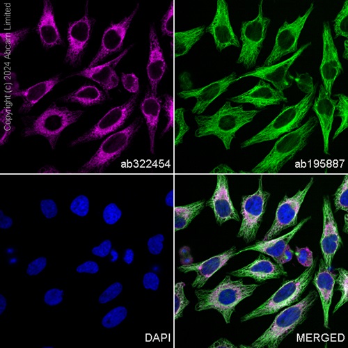 Immunocytochemistry/ Immunofluorescence - Alexa Fluor® 488 Anti-alpha Tubulin antibody [DM1A] - Microtubule Marker (ab195887), expandable thumbnail