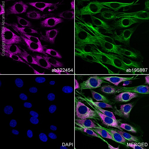 Immunocytochemistry/ Immunofluorescence - Alexa Fluor® 488 Anti-alpha Tubulin antibody [DM1A] - Microtubule Marker (ab195887), expandable thumbnail