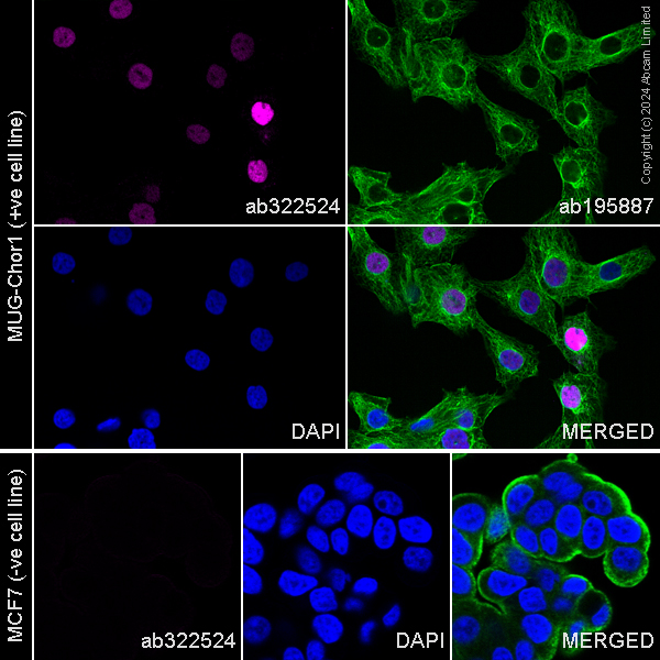 Immunocytochemistry/ Immunofluorescence - Alexa Fluor® 488 Anti-alpha Tubulin antibody [DM1A] - Microtubule Marker (ab195887), expandable thumbnail
