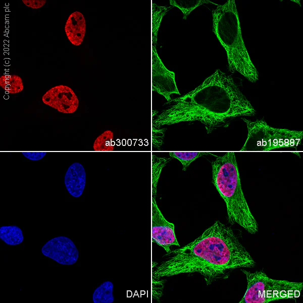 Immunocytochemistry/ Immunofluorescence - Alexa Fluor® 488 Anti-alpha Tubulin antibody [DM1A] - Microtubule Marker (AB195887)