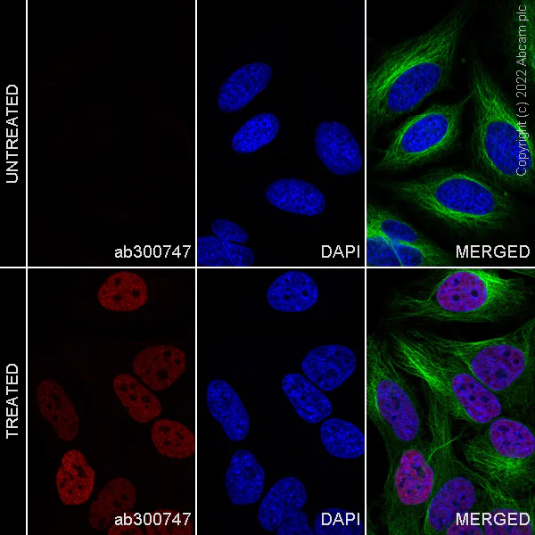 Immunocytochemistry/ Immunofluorescence - Alexa Fluor® 488 Anti-alpha Tubulin antibody [DM1A] - Microtubule Marker (AB195887)