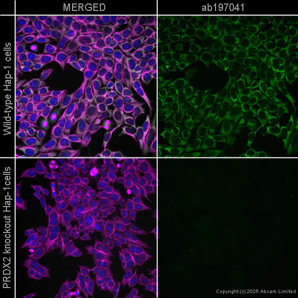 Immunocytochemistry/ Immunofluorescence - Alexa Fluor® 488 Anti-alpha Tubulin antibody [DM1A] - Microtubule Marker (AB195887)