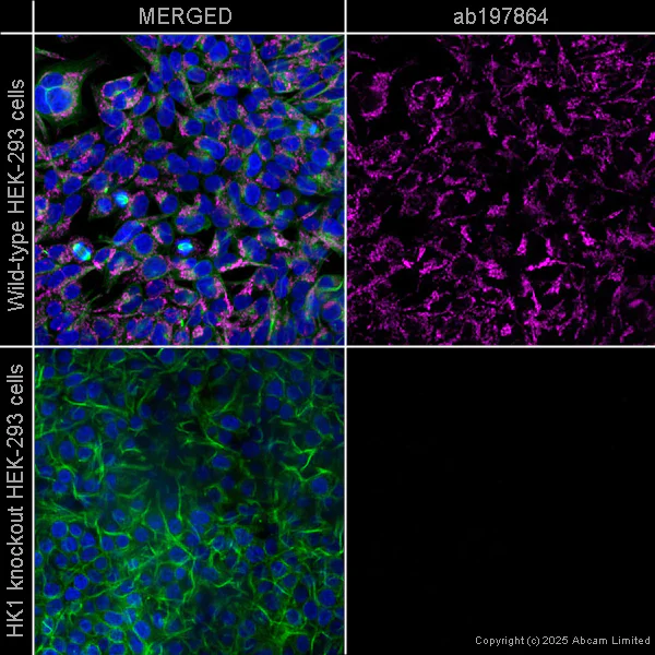 Immunocytochemistry/ Immunofluorescence - Alexa Fluor® 488 Anti-alpha Tubulin antibody [DM1A] - Microtubule Marker (AB195887)