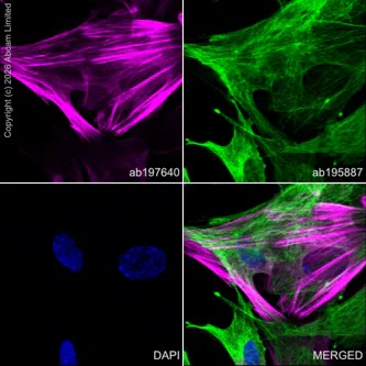 Immunocytochemistry/ Immunofluorescence - Alexa Fluor® 488 Anti-alpha Tubulin antibody [DM1A] - Microtubule Marker (AB195887)