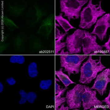 Immunocytochemistry/ Immunofluorescence - Alexa Fluor® 488 Anti-alpha Tubulin antibody [DM1A] - Microtubule Marker (AB195887)