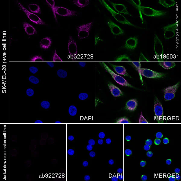 Immunocytochemistry/ Immunofluorescence - Alexa Fluor® 488 Anti-alpha Tubulin antibody [EP1332Y] - Microtubule Marker (AB185031)