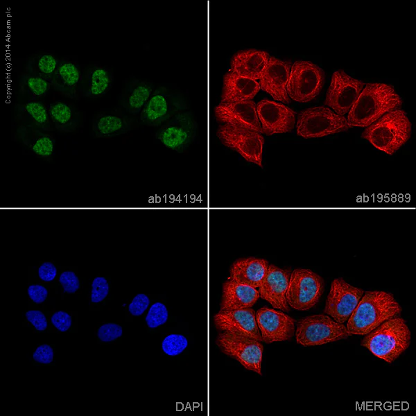 Immunocytochemistry/ Immunofluorescence - Alexa Fluor® 488 Anti-Androgen Receptor antibody [EPR1535(2)] (AB194194)