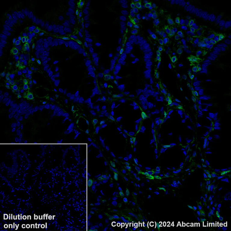Immunohistochemistry (Formalin/PFA-fixed paraffin-embedded sections) - Alexa Fluor® 488 Anti-Annexin A1/ANXA1 antibody [EPR19342] (AB225513)