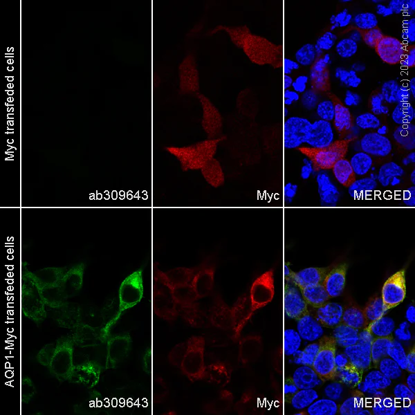 Immunocytochemistry/ Immunofluorescence - Alexa Fluor® 488 Anti-Aquaporin 1 antibody [EPR11588(B)] (AB309643)
