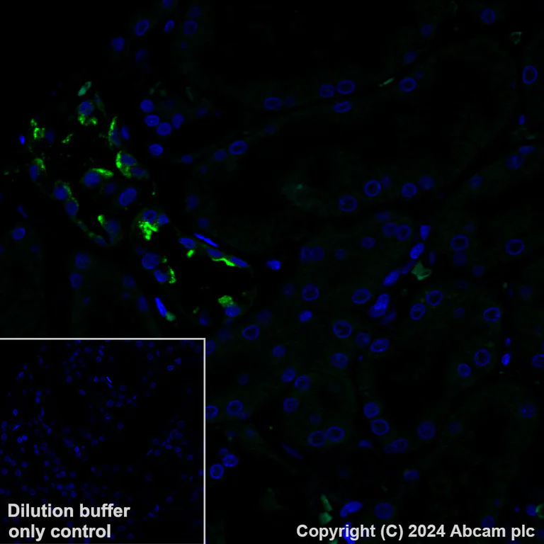 Immunohistochemistry (Formalin/PFA-fixed paraffin-embedded sections) - Alexa Fluor® 488 Anti-Aquaporin 2 antibody [EPR21080] (AB323995)