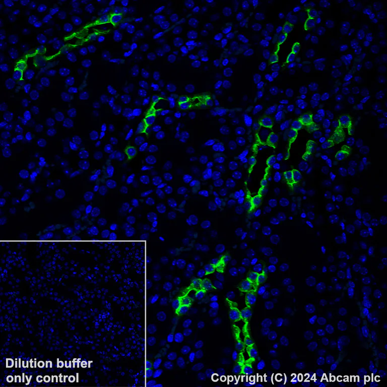 Immunohistochemistry (Formalin/PFA-fixed paraffin-embedded sections) - Alexa Fluor® 488 Anti-Aquaporin 2 antibody [EPR21080] (AB323995)