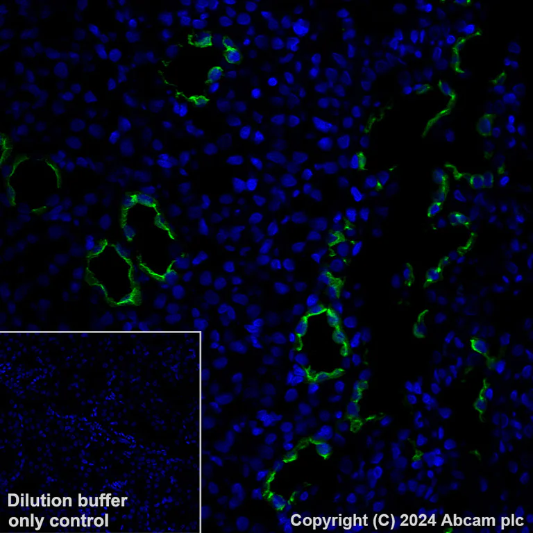 Immunohistochemistry (Formalin/PFA-fixed paraffin-embedded sections) - Alexa Fluor® 488 Anti-Aquaporin 2 antibody [EPR21080] (AB323995)