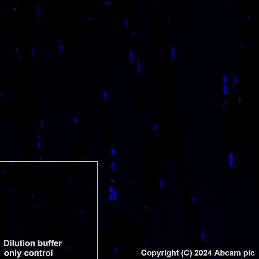 Immunohistochemistry (Formalin/PFA-fixed paraffin-embedded sections) - Alexa Fluor® 488 Anti-Aquaporin 2 antibody [EPR21080] (AB323995), expandable thumbnail