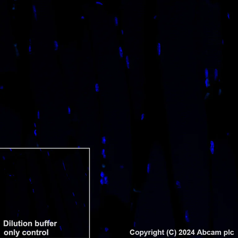 Immunohistochemistry (Formalin/PFA-fixed paraffin-embedded sections) - Alexa Fluor® 488 Anti-Aquaporin 2 antibody [EPR21080] (AB323995)