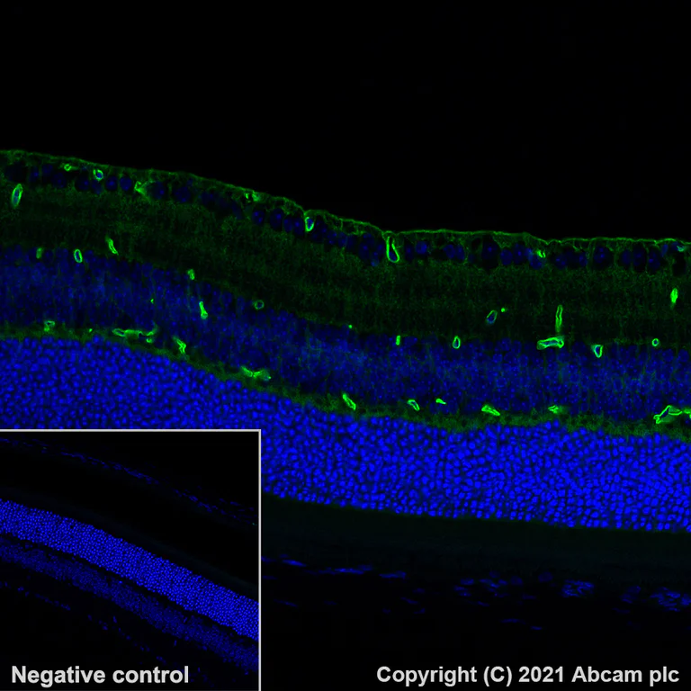 Immunohistochemistry (Formalin/PFA-fixed paraffin-embedded sections) - Alexa Fluor® 488 Anti-Aquaporin 4 antibody [EPR24281-65] (AB284135)