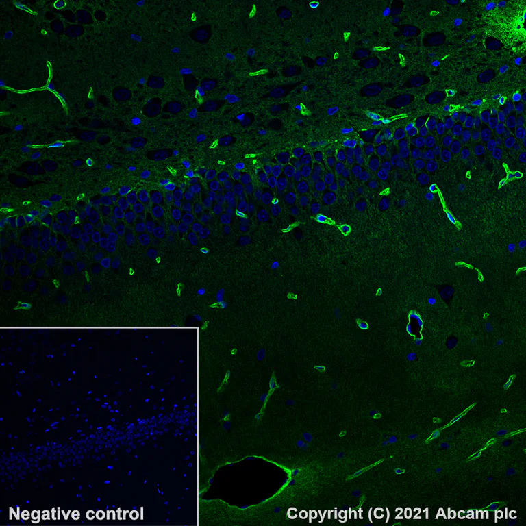 Immunohistochemistry (Formalin/PFA-fixed paraffin-embedded sections) - Alexa Fluor® 488 Anti-Aquaporin 4 antibody [EPR24281-65] (AB284135)