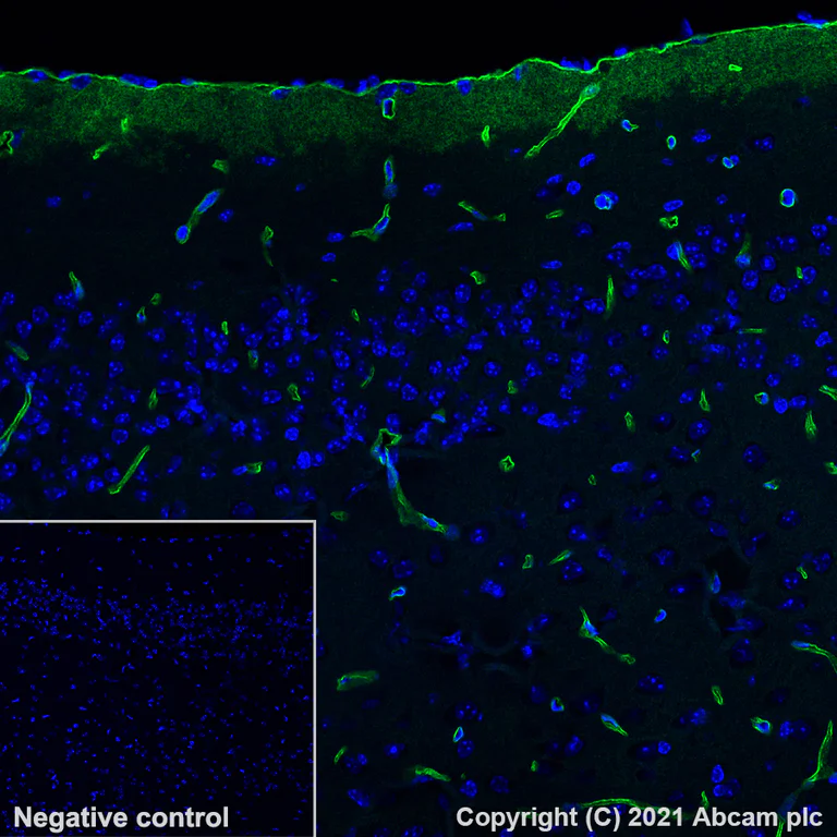Immunohistochemistry (Formalin/PFA-fixed paraffin-embedded sections) - Alexa Fluor® 488 Anti-Aquaporin 4 antibody [EPR24281-65] (AB284135)