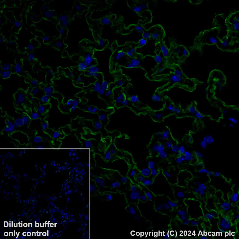 Immunohistochemistry (Formalin/PFA-fixed paraffin-embedded sections) - Alexa Fluor® 488 Anti-Aquaporin 5 antibody [EPR27474-70] (AB317295)