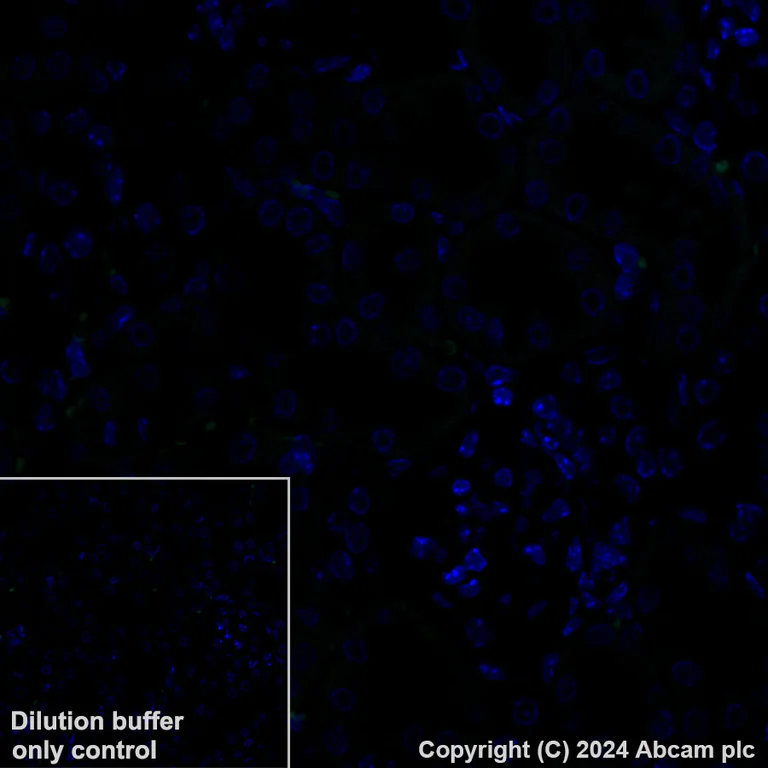 Immunohistochemistry (Formalin/PFA-fixed paraffin-embedded sections) - Alexa Fluor® 488 Anti-Aquaporin 5 antibody [EPR27474-70] (AB317295)