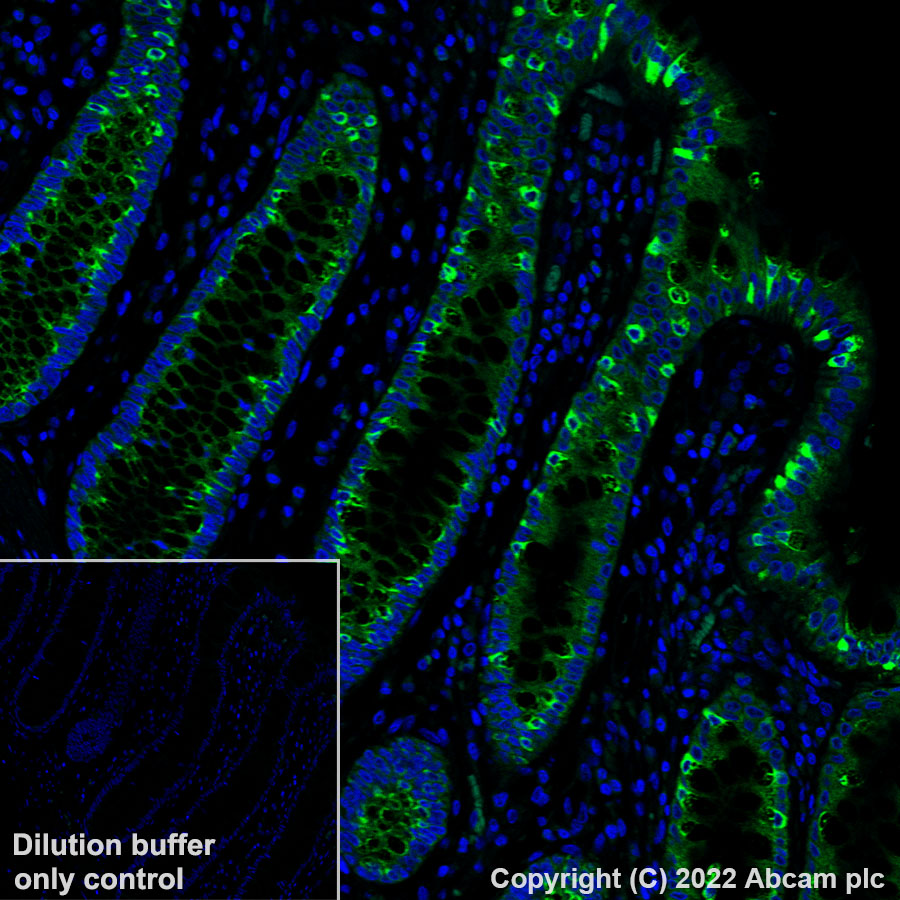 Alexa Fluor® 488 Anti-Aquaporin 5 antibody [EPR3747] (ab308598
