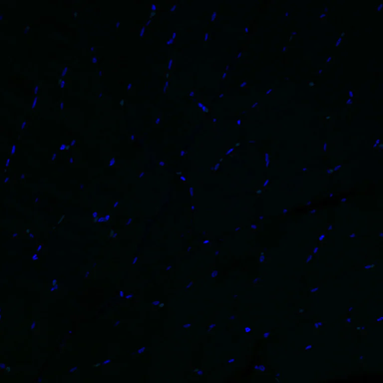 Immunohistochemistry (Formalin/PFA-fixed paraffin-embedded sections) - Alexa Fluor® 488 Anti-Aquaporin 5 antibody [EPR3747] (AB308598)