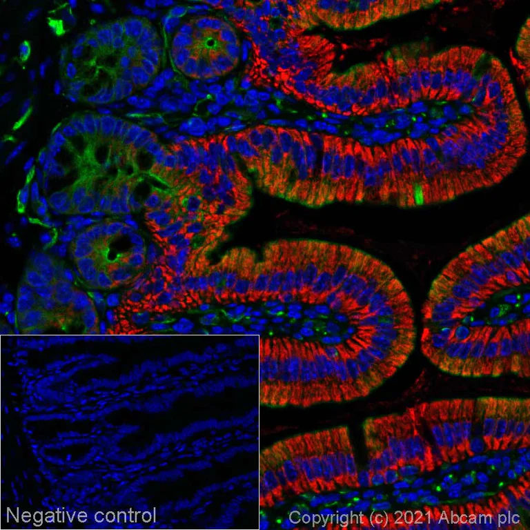 Immunohistochemistry (Formalin/PFA-fixed paraffin-embedded sections) - Alexa Fluor® 488 Anti-Arg2 antibody [EPR22626-38] (AB281754)