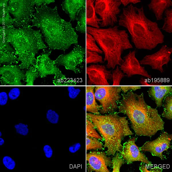 Immunocytochemistry/ Immunofluorescence - Alexa Fluor® 488 Anti-ARPC2 antibody [EPR8533] (AB223423)