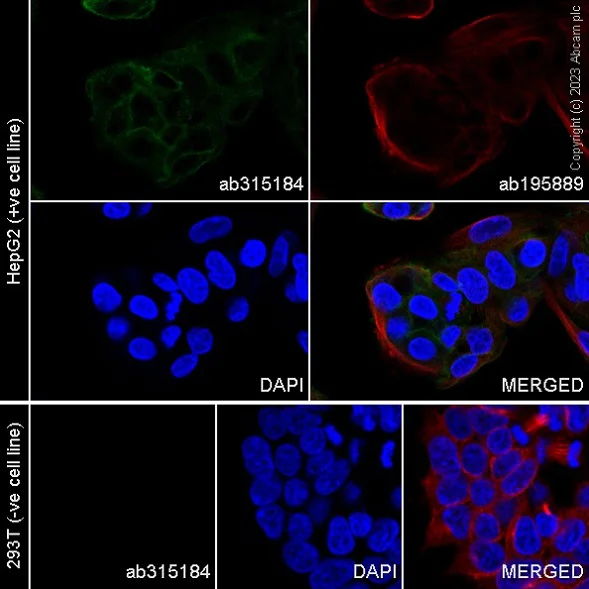 Immunocytochemistry/ Immunofluorescence - Alexa Fluor® 488 Anti-Asialoglycoprotein Receptor 1/HL-1 antibody [EPR22642-17] (AB315184)