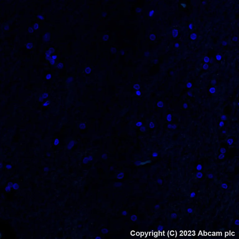 Immunohistochemistry (Formalin/PFA-fixed paraffin-embedded sections) - Alexa Fluor® 488 Anti-Asialoglycoprotein Receptor 1/HL-1 antibody [EPR22642-17] (AB315184)