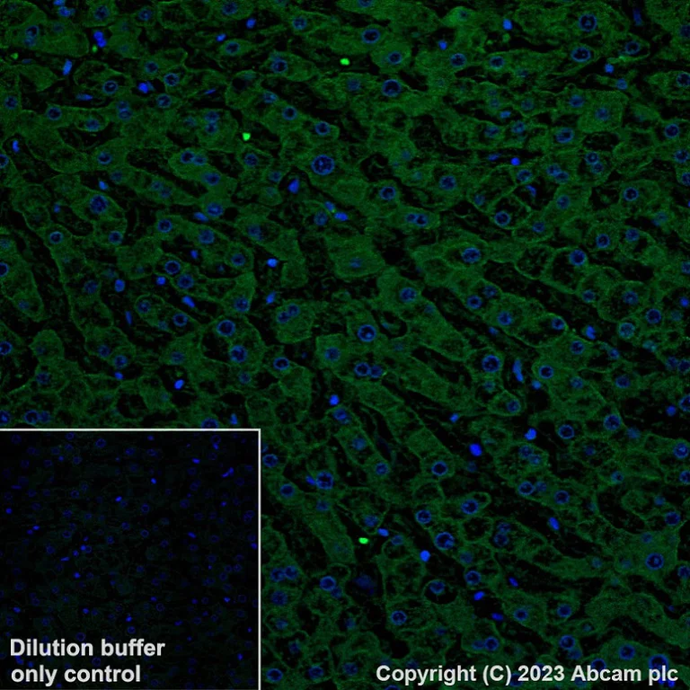 Immunohistochemistry (Formalin/PFA-fixed paraffin-embedded sections) - Alexa Fluor® 488 Anti-Asialoglycoprotein Receptor 1/HL-1 antibody [EPR22642-17] (AB315184)