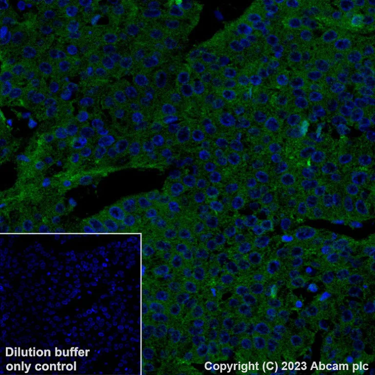 Immunohistochemistry (Formalin/PFA-fixed paraffin-embedded sections) - Alexa Fluor® 488 Anti-Asialoglycoprotein Receptor 1/HL-1 antibody [EPR22642-17] (AB315184)