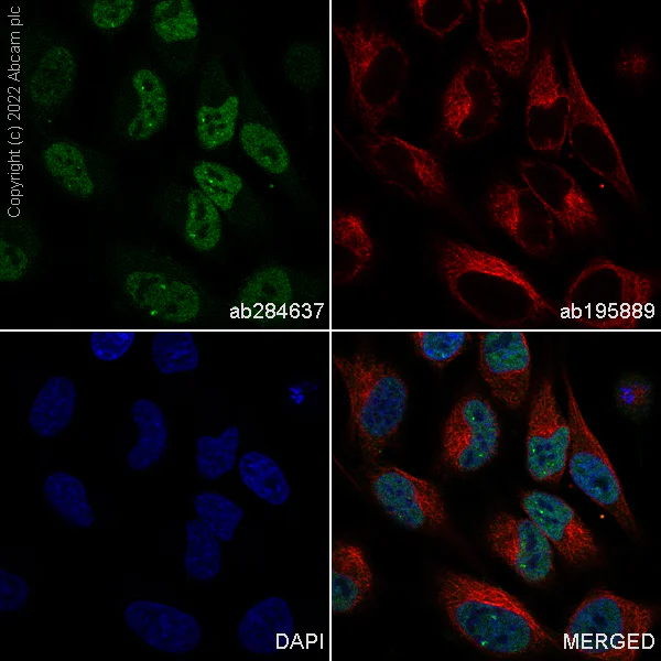 Immunocytochemistry/ Immunofluorescence - Alexa Fluor® 488 Anti-ATM antibody [SP224] (AB284637)