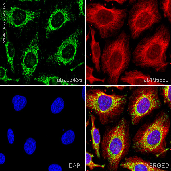 Immunocytochemistry/ Immunofluorescence - Alexa Fluor® 488 Anti-ATPB antibody [EPR11990] (AB223435), expandable thumbnail