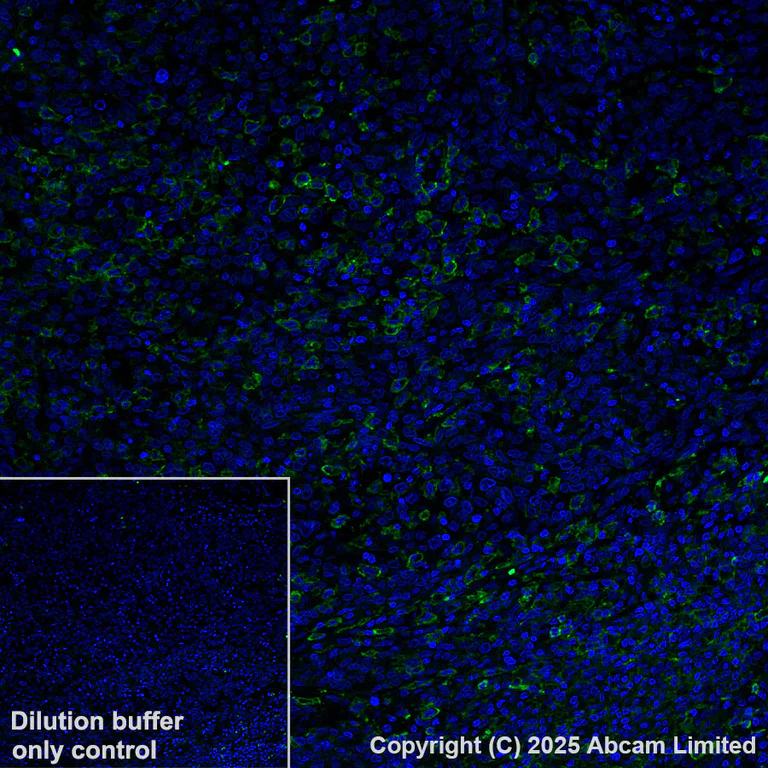Immunohistochemistry (Formalin/PFA-fixed paraffin-embedded sections) - Alexa Fluor® 488 Anti-B7-H6 antibody [EPR28658-68] (AB325258)