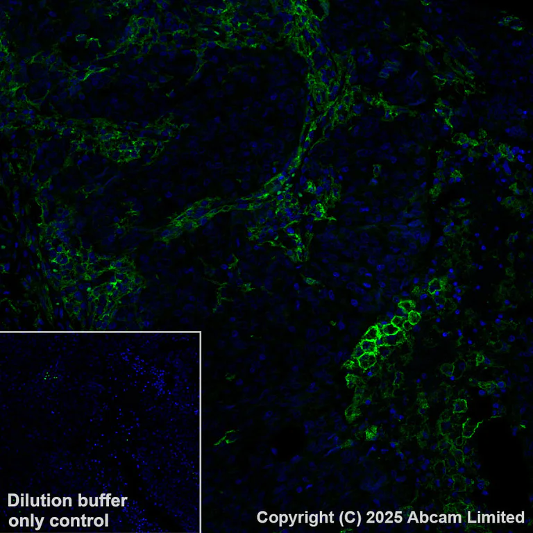 Immunohistochemistry (Formalin/PFA-fixed paraffin-embedded sections) - Alexa Fluor® 488 Anti-B7-H6 antibody [EPR28658-68] (AB325258)