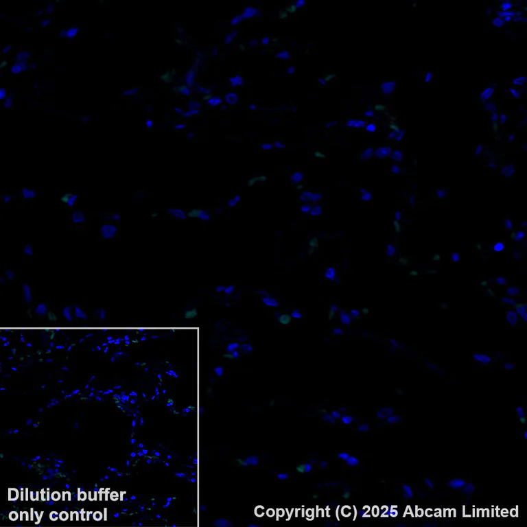 Immunohistochemistry (Formalin/PFA-fixed paraffin-embedded sections) - Alexa Fluor® 488 Anti-B7-H6 antibody [EPR28658-68] (AB325258)