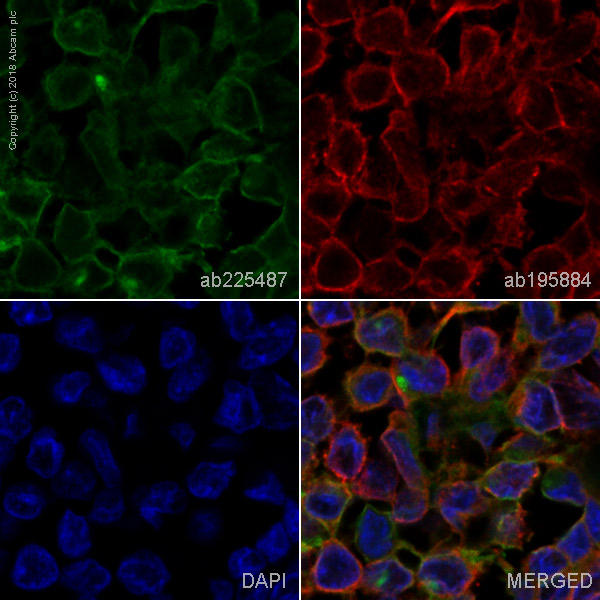 Immunohistochemistry (Formalin/PFA-fixed paraffin-embedded sections) - Alexa Fluor® 488 Anti-B7H4 antibody [EPR20236] (AB225487)