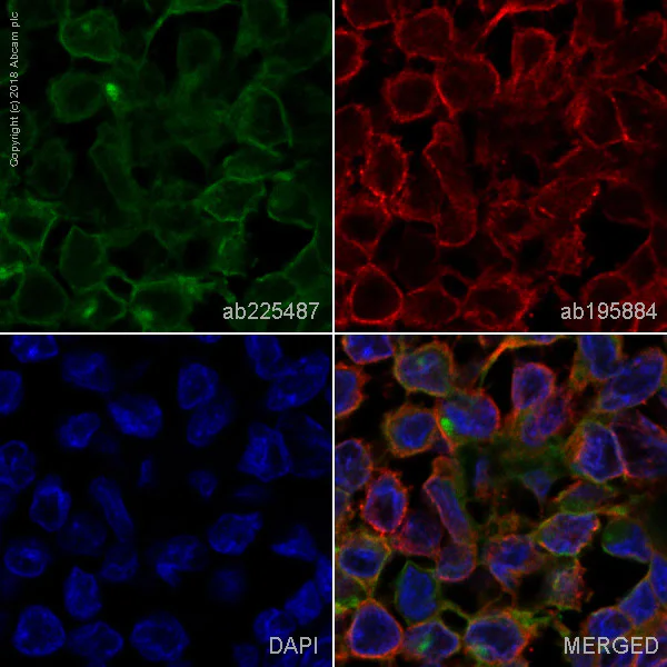 Immunohistochemistry (Formalin/PFA-fixed paraffin-embedded sections) - Alexa Fluor® 488 Anti-B7H4 antibody [EPR20236] (AB225487)