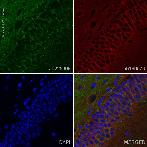 Immunohistochemistry (Formalin/PFA-fixed paraffin-embedded sections) - Alexa Fluor® 488 Anti-BACE1 antibody [EPR19523] (AB225308)
