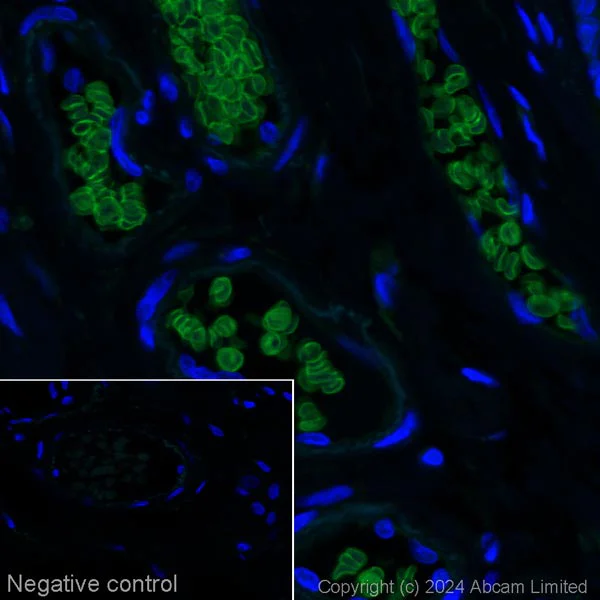 Immunohistochemistry (Formalin/PFA-fixed paraffin-embedded sections) - Alexa Fluor® 488 Anti-Band 3/AE 1 antibody [EPR1426] (AB225081)