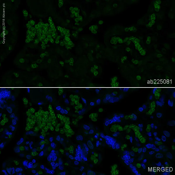 Immunohistochemistry (Formalin/PFA-fixed paraffin-embedded sections) - Alexa Fluor® 488 Anti-Band 3/AE 1 antibody [EPR1426] (AB225081)
