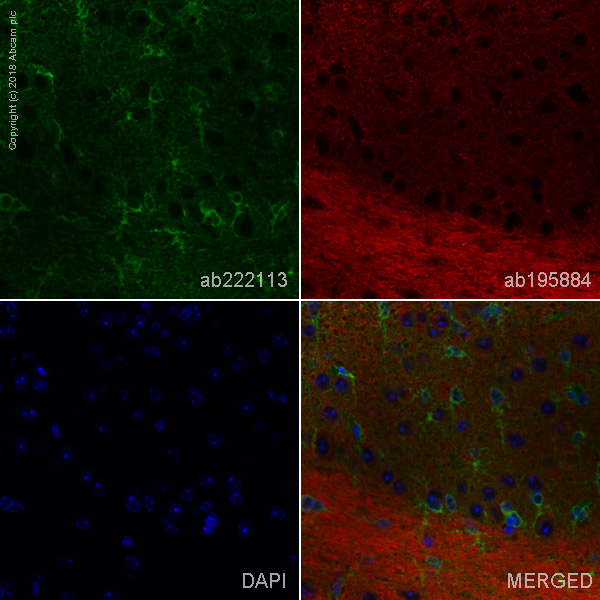 Immunohistochemistry (Formalin/PFA-fixed paraffin-embedded sections) - Alexa Fluor® 488 Anti-BDNF antibody [EPR1292] (AB222113), expandable thumbnail