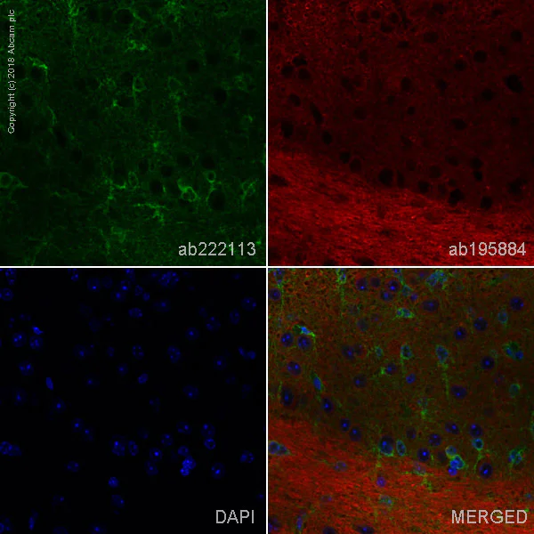 Immunohistochemistry (Formalin/PFA-fixed paraffin-embedded sections) - Alexa Fluor® 488 Anti-BDNF antibody [EPR1292] (AB222113)