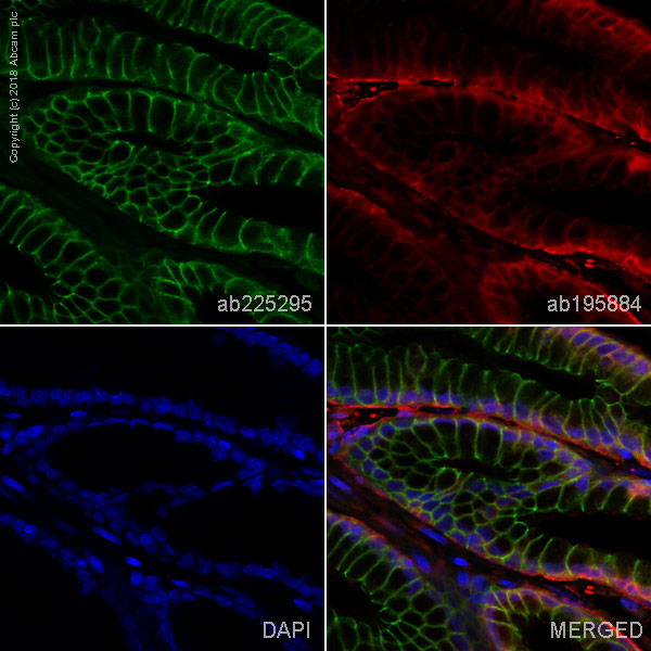 Immunohistochemistry (Formalin/PFA-fixed paraffin-embedded sections) - Alexa Fluor® 488 Anti-beta 2 Adrenergic Receptor antibody [EPR707(N)] (AB225295)