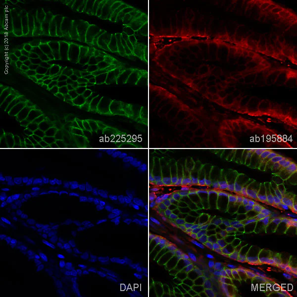 Immunohistochemistry (Formalin/PFA-fixed paraffin-embedded sections) - Alexa Fluor® 488 Anti-beta 2 Adrenergic Receptor antibody [EPR707(N)] (AB225295)