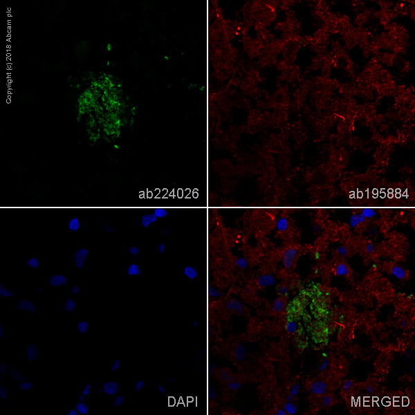 Immunohistochemistry (Frozen sections) - Alexa Fluor® 488 Anti-beta Amyloid 1-42 antibody [mOC64] (AB224026), expandable thumbnail