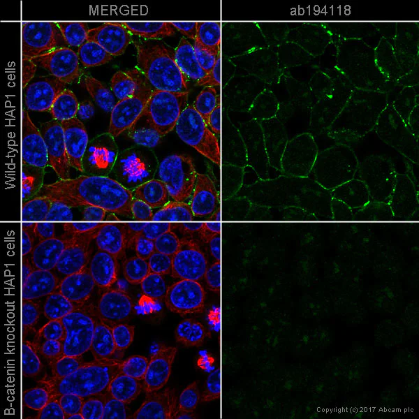 Immunocytochemistry/ Immunofluorescence - Alexa Fluor® 488 Anti-beta Catenin antibody [E247] (AB194118)