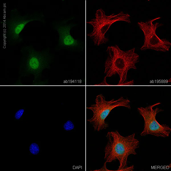 Immunocytochemistry/ Immunofluorescence - Alexa Fluor® 488 Anti-beta Catenin antibody [E247] (AB194118)
